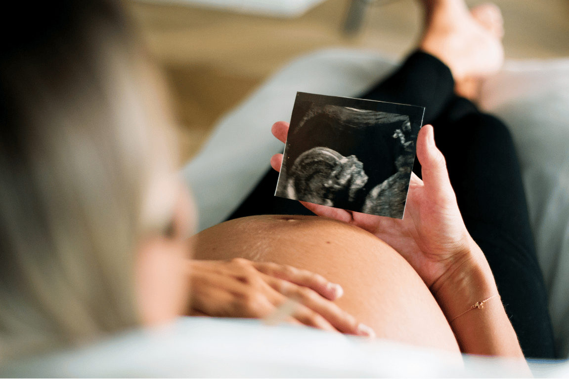 Women with pregnancy sickness looking at a scan of her baby